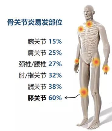 案例数字化转型频道_天极网